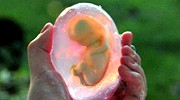 胎儿竟然被用来做肥皂？那些没见过的震撼照片
