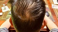 新浪20岁生日 微博CEO晒后脑勺照片：头开始秃了