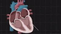 美国研发新设备ULiSSES 可使心脏在体外跳动24小时