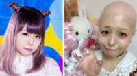 日本少女偶像患上“脱毛症” 勇敢公开光头长相
