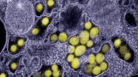 日本发现能传染人类的新病毒Yezo：会导致高烧39度