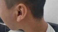 男子长期戴耳机睡觉左耳听觉丧失 本人：仅半年时间
