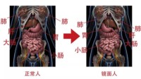 一女子五脏六腑全部反着长 医生解释：是镜面人