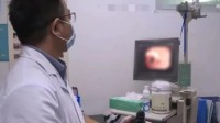 男子鸡骨卡喉喝醋吞饭致食道穿孔 医生：土方不可取