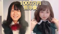 日本少女分享整容经验走红 已花费超1000万日元