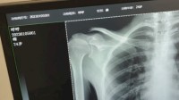 女子在宠物医院拍肺部片子 到“24岁雌性”绷不住了