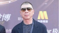 Controversy Surrounds Feng Xiaogang's Disappearance of Vitiligo, Doctors Provide Answers