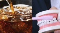 男孩饮料上瘾牙全烂14岁戴假牙 把碳酸饮料当水喝