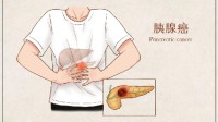 阿里立功：面对“癌症之王”不再束手无策