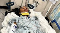 《黑豹》女演员遭遇车祸重伤：在餐厅吃饭时祸从天降