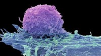 用魔法打败魔法！工程T细胞杀癌能力提高百倍