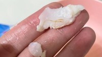 进口鳕鱼发现寄生虫？山姆会员店回应：属正常现象