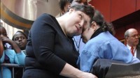 62岁连体双胞胎去世 曾被断言活不过30岁