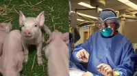 全球首例猪肾移植患者死亡 没有迹象表明移植是死因