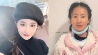 女生确诊渐冻症一年容貌巨变：呼吸吞咽都要尽全力
