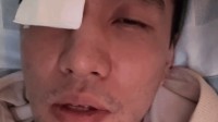 经纪人回应郭艾伦最新情况：曾经历短暂失明