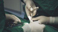 美国机器人自主完成胆囊切除手术 表现堪比资深医生