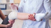 浙大研发全球首款骨胶水：粉碎性骨折一粘即可！