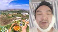 游客坐过山车颈椎骨折 郑州方特回应：不会推卸责任